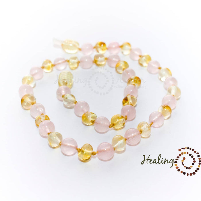 Healing Amber | Amber Necklaces, Assorted Styles